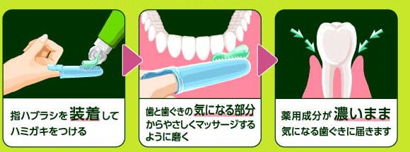 产后月子期刷牙神器！花王KAO 深层清洁预防齿龈炎手指牙刷 药用牙膏套装 100g